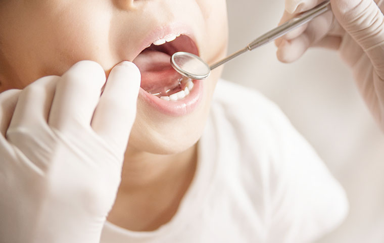 子供が虫歯になる原因とは？