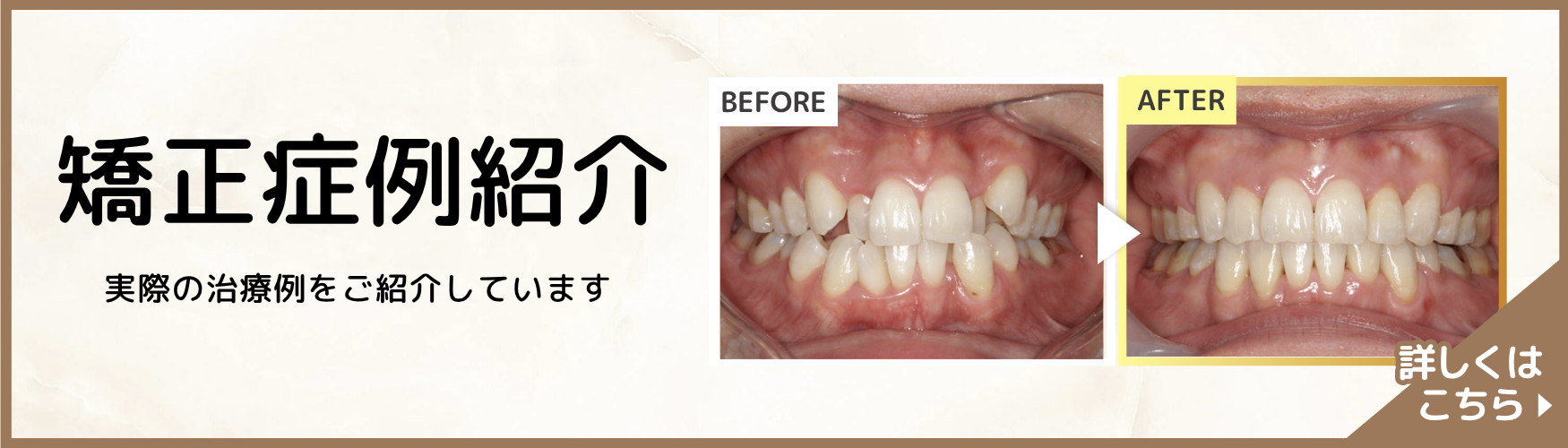 矯正歯科バナー
