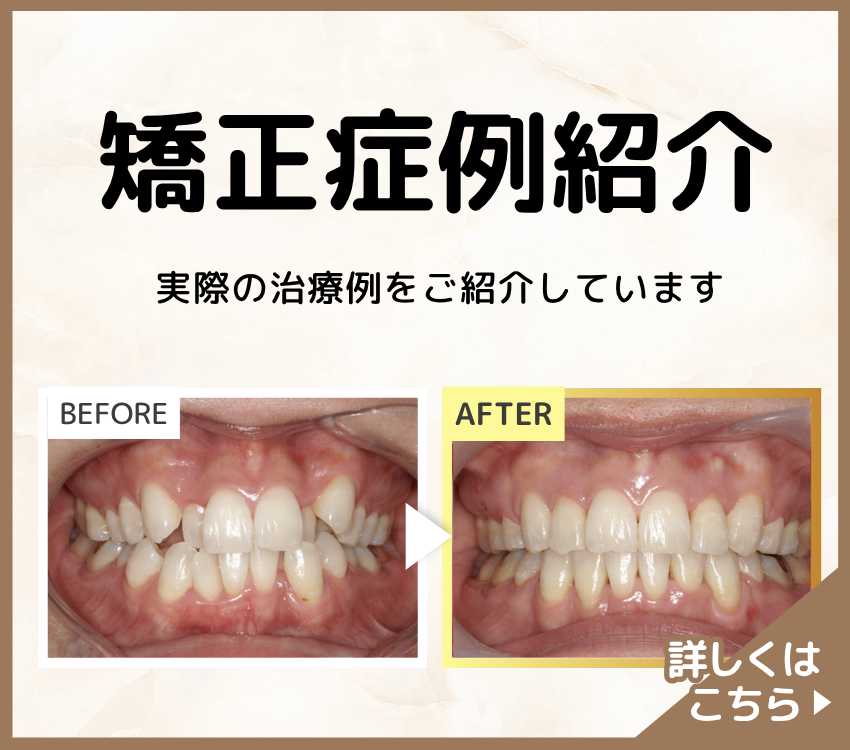 矯正歯科バナー