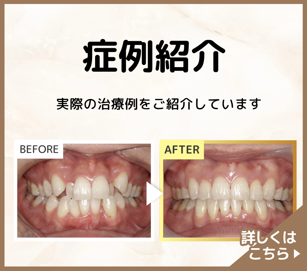 症例バナー